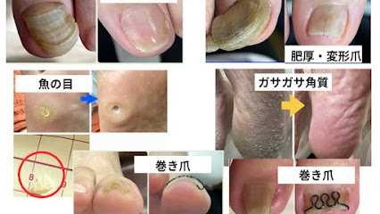 フットケアサロンナチュエイド, 札幌